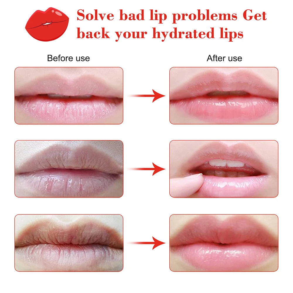 Mascarilla labial con vitamina, hidratante para la piel, mejora la sequedad, elimina la piel muerta, parches para labios